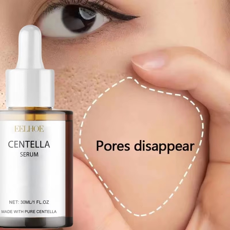 Luxury Skincare Korea - Centella Asiatica Porenverfeinerndes Gesichtsserum gegen Rötungen,